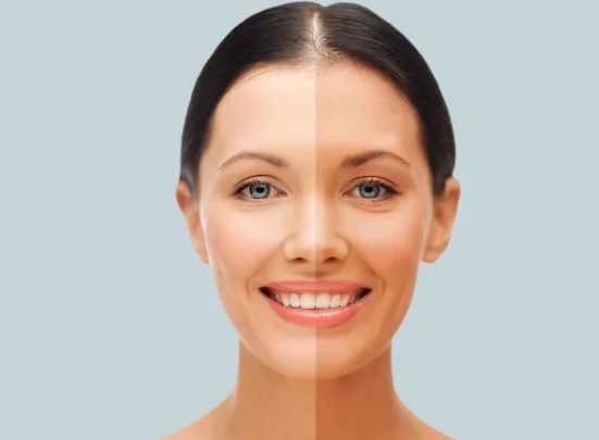whitening injection Whitening injection price in pakistan Glutathione injection