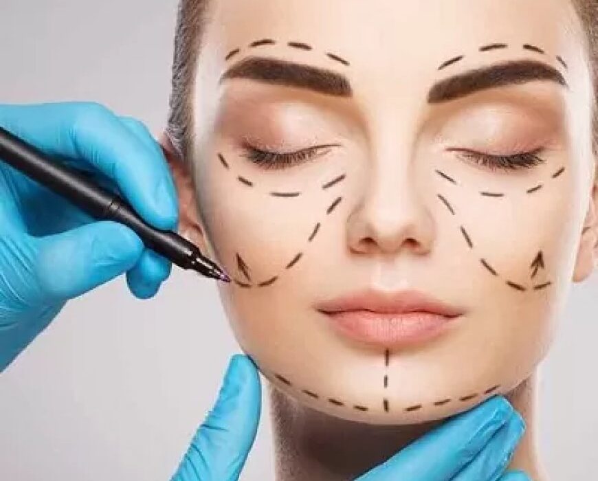Best Plastic Surgeon in Jeddah: What to Look for When Choosing the Right Expert